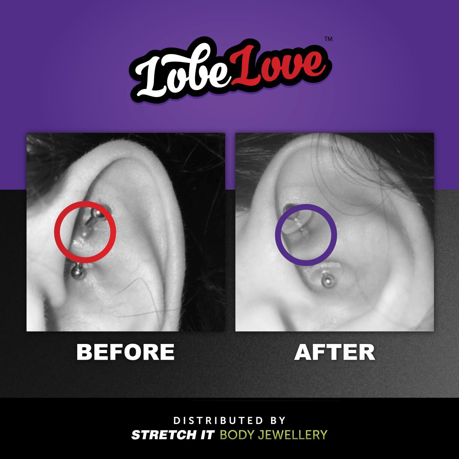 LobeLove™ Healing Disc Before & After