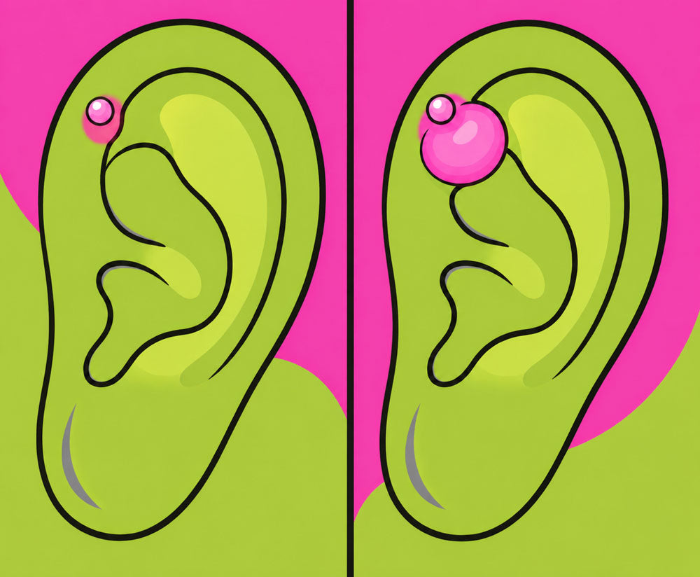 Piercing Bump VS Keloid